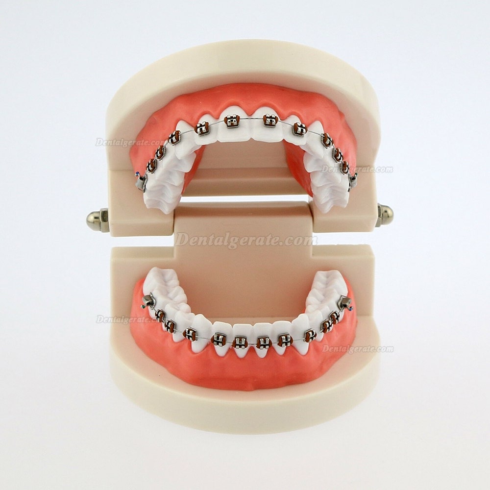 Dental Teach Typodont Demonstrationszahnmodell mit Zahnspangen F&uuml;r die Patientenstudie 5006
